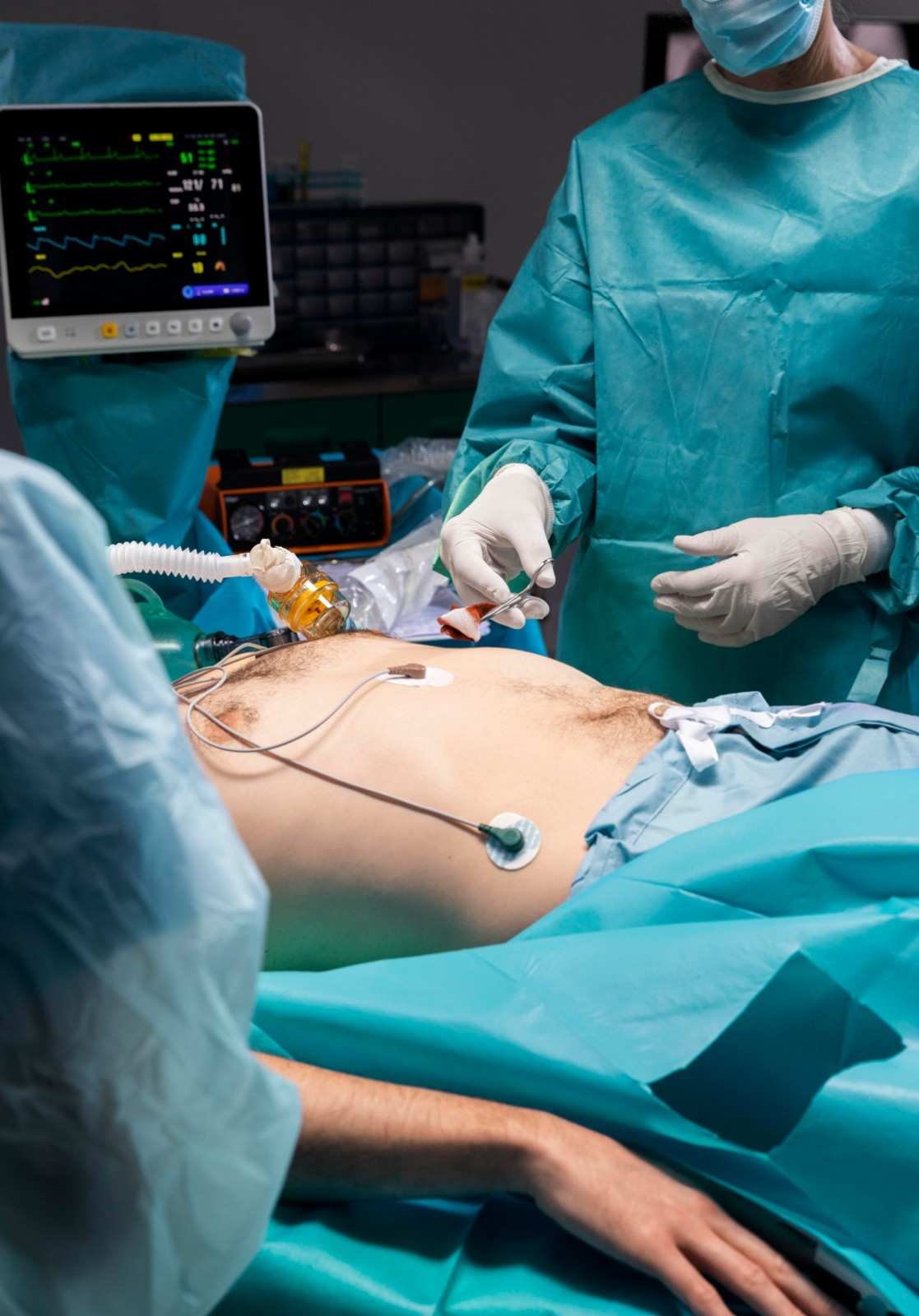 Best Laparoscopy Surgery in Greater Noida