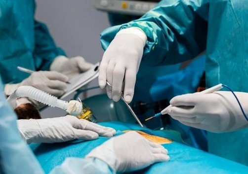 Best Laparoscopy Surgery in Greater Noida