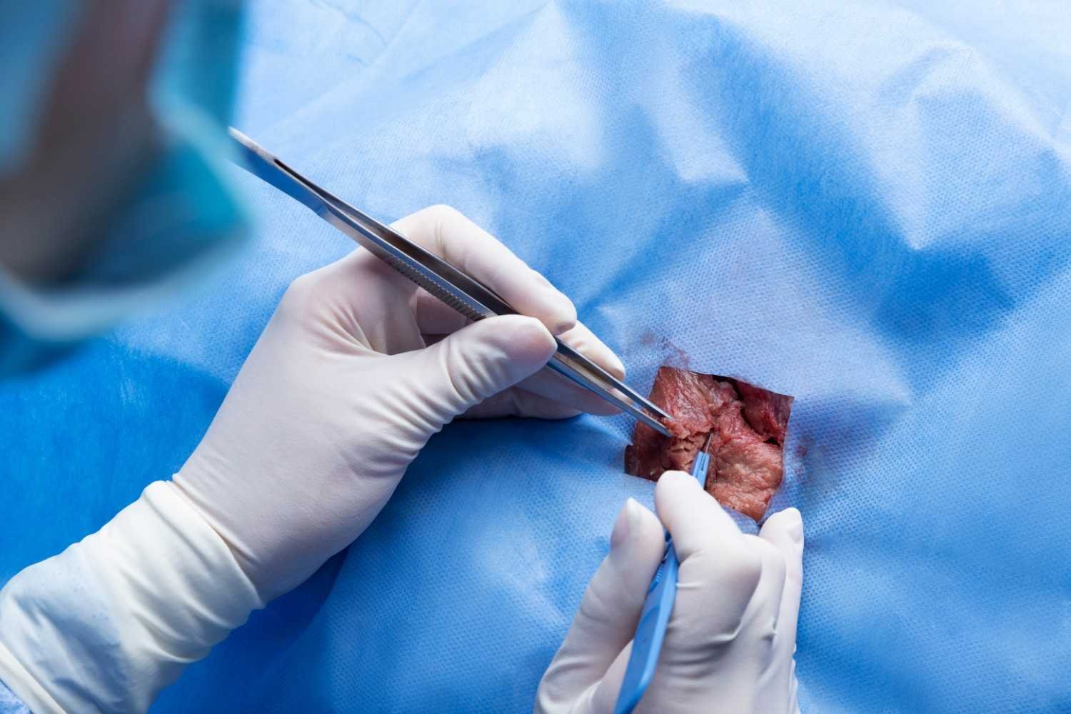 Hysteroscopic Surgeon in Greater Noida